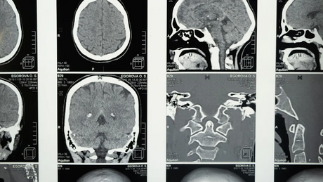 Large Neodymium Magnets Comparing Grades and Coatings for Your Application.png