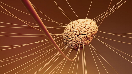 Magnetic Domains and Magnetic Domain Walls.png